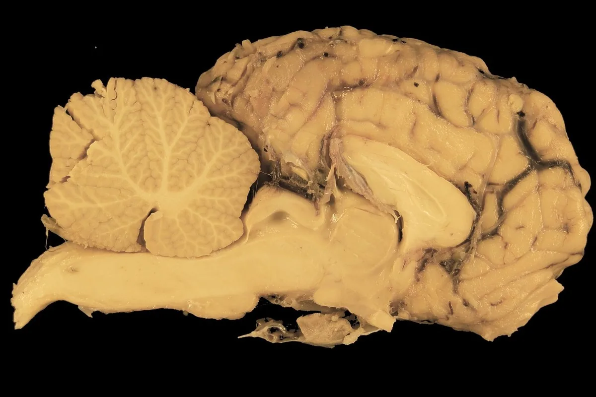 Crinière de lion au Maroc : mémoire & concentration 20 Schéma stylisé d'un cerveau et de ses réseaux de neurones, illustrant la mémoire et les connexions nerveuses